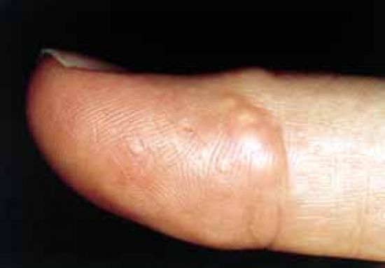 Fingertophus.jpg